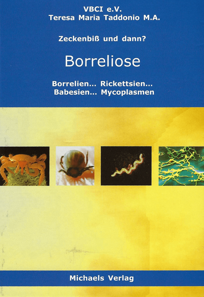 Buchcover: Zeckenbiss und dann?